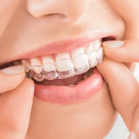 whitening gels